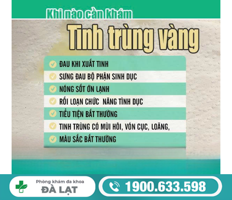 Hình ảnh minh họa